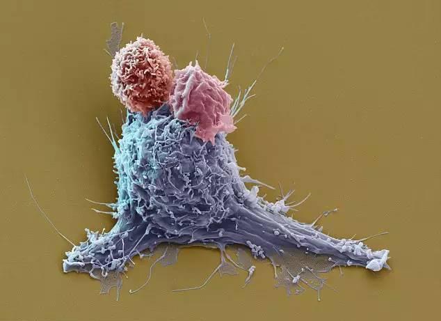 循環(huán)腫瘤細胞與免疫細胞的相互作用與臨床價值